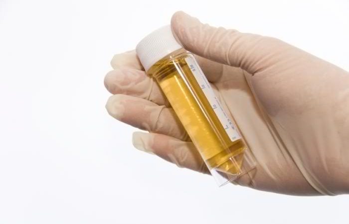 What Causes Blood Clots in Urine? When to worry?